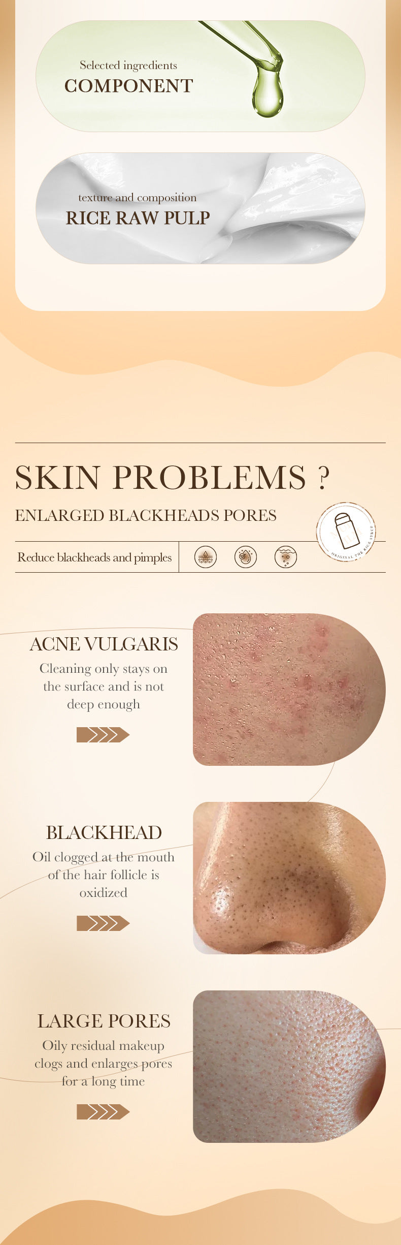 Facial Remove Blackhead Rice Solid Mask Acne Blemish Black Dots Clean Face Shrink Pores Stick Cream Brighten Korean Skincare New