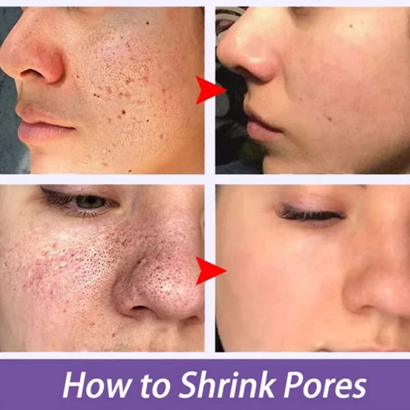 Facial Remove Blackhead Rice Solid Mask Acne Blemish Black Dots Clean Face Shrink Pores Stick Cream Brighten Korean Skincare New