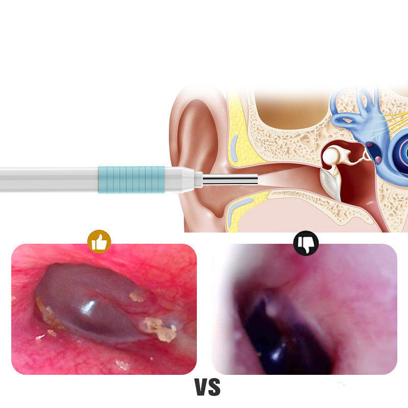 New HD Intelligent Endoscope Tool