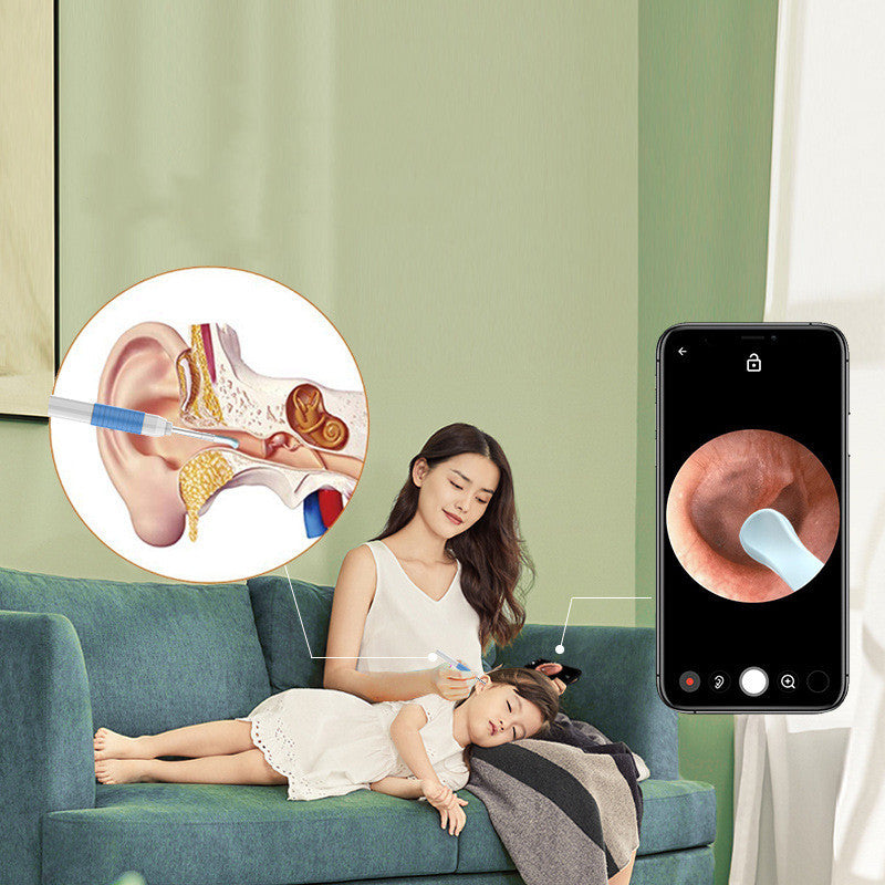 New HD Intelligent Endoscope Tool